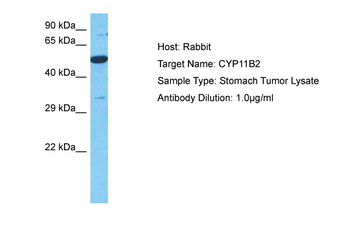 CYP11B2 Rabbit Polyclonal Antibody