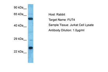 FUT4 Rabbit Polyclonal Antibody