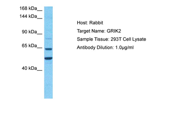 GRIK2 Rabbit Polyclonal Antibody