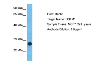 GSTM1 Rabbit Polyclonal Antibody