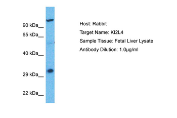 KIR2DL4 Rabbit Polyclonal Antibody
