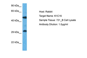 KRT16 Rabbit Polyclonal Antibody
