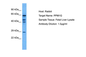 PPM1G Rabbit Polyclonal Antibody