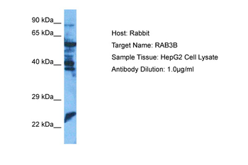 RAB3B Rabbit Polyclonal Antibody