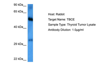 TBCE Rabbit Polyclonal Antibody
