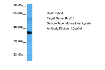 TNFAIP1 Rabbit Polyclonal Antibody