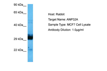 ANP32A Rabbit Polyclonal Antibody