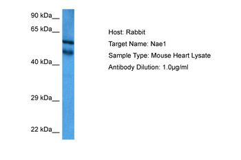 NAE1 Rabbit Polyclonal Antibody