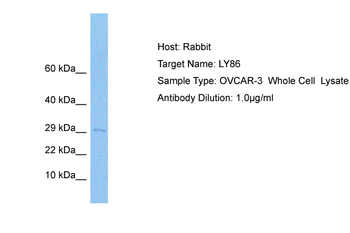 LY86 Rabbit Polyclonal Antibody