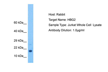 MTSS1 Rabbit Polyclonal Antibody