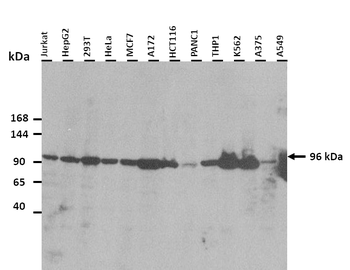 PDCD6IP Rabbit Polyclonal Antibody