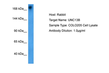 UNC13B Rabbit Polyclonal Antibody