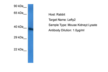 LEFTY2 Rabbit Polyclonal Antibody