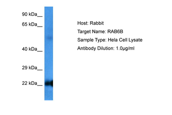 RAB6B Rabbit Polyclonal Antibody