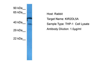 KIR2DL5A Rabbit Polyclonal Antibody