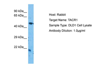 TACR1 Rabbit Polyclonal Antibody