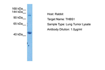 THBS1 Rabbit Polyclonal Antibody
