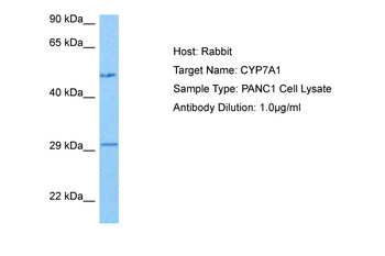 CYP7A1 Rabbit Polyclonal Antibody