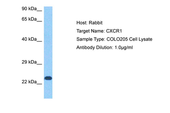 CXCR1 Rabbit Polyclonal Antibody