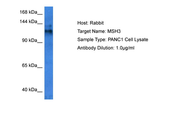 MSH3 Rabbit Polyclonal Antibody