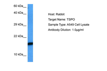 TSPO Rabbit Polyclonal Antibody
