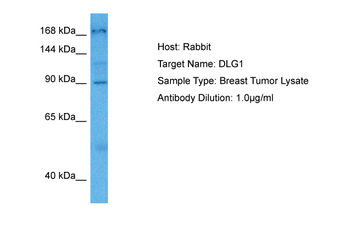 DLG1 Rabbit Polyclonal Antibody