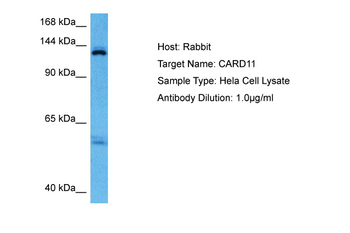 CARD11 Rabbit Polyclonal Antibody