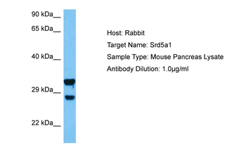 SRD5A1 Rabbit Polyclonal Antibody