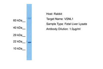 VSNL1 Rabbit Polyclonal Antibody