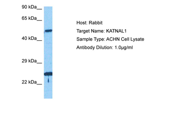 KATNAL1 Rabbit Polyclonal Antibody