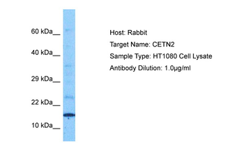 CETN2 Rabbit Polyclonal Antibody