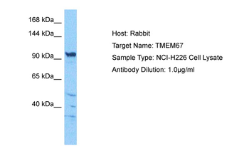 TMEM67 Rabbit Polyclonal Antibody