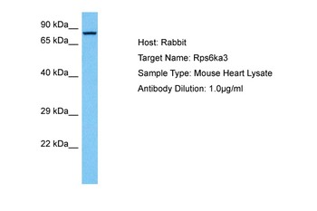 RPS6KA3 Rabbit Polyclonal Antibody