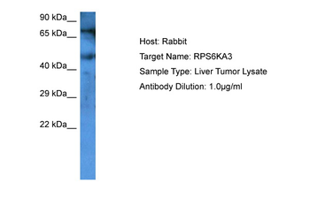 RPS6KA3 Rabbit Polyclonal Antibody