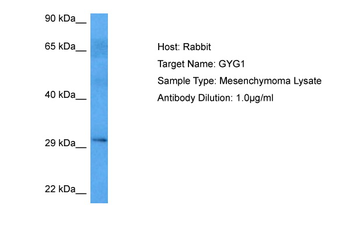 GYG1 Rabbit Polyclonal Antibody