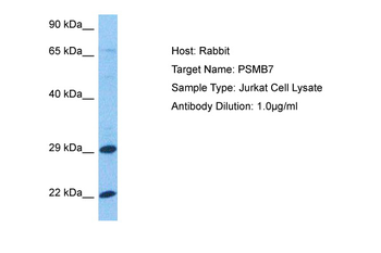 PSMB7 Rabbit Polyclonal Antibody