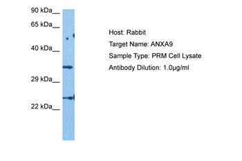 ANXA9 Rabbit Polyclonal Antibody