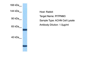 PITPNM3 Rabbit Polyclonal Antibody