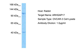 ARHGAP17 Rabbit Polyclonal Antibody