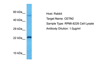 CETN2 Rabbit Polyclonal Antibody