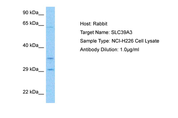 SLC39A3 Rabbit Polyclonal Antibody