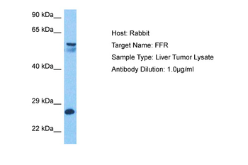 VPS51 Rabbit Polyclonal Antibody