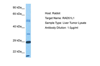 RAD51B Rabbit Polyclonal Antibody