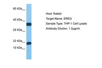 EREG Rabbit Polyclonal Antibody