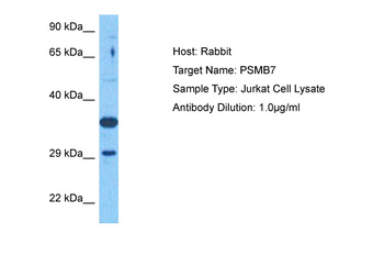PSMB7 Rabbit Polyclonal Antibody
