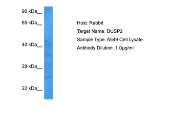 DUSP2 Rabbit Polyclonal Antibody