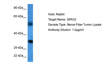 GPA33 Rabbit Polyclonal Antibody