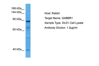 GABBR1 Rabbit Polyclonal Antibody