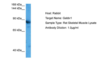 GABBR1 Rabbit Polyclonal Antibody