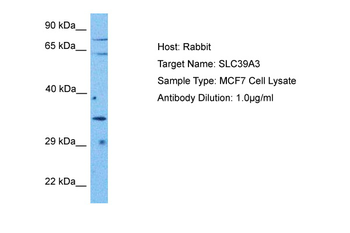 SLC39A3 Rabbit Polyclonal Antibody